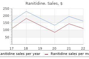 cheap 150 mg ranitidine with visa