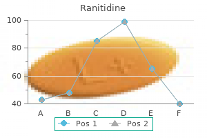 purchase 150mg ranitidine otc