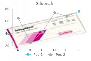 cheap sildenafil generic