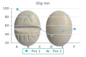 discount slip inn online amex