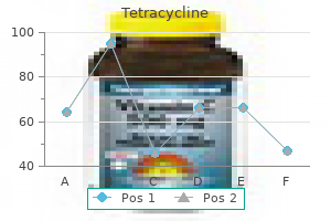 buy tetracycline on line amex