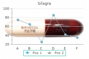 buy silagra 50 mg low cost