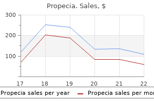 buy 1mg propecia with visa