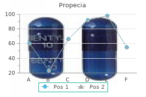 purchase propecia 1mg line