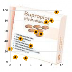 Brown-S?quard syndrome